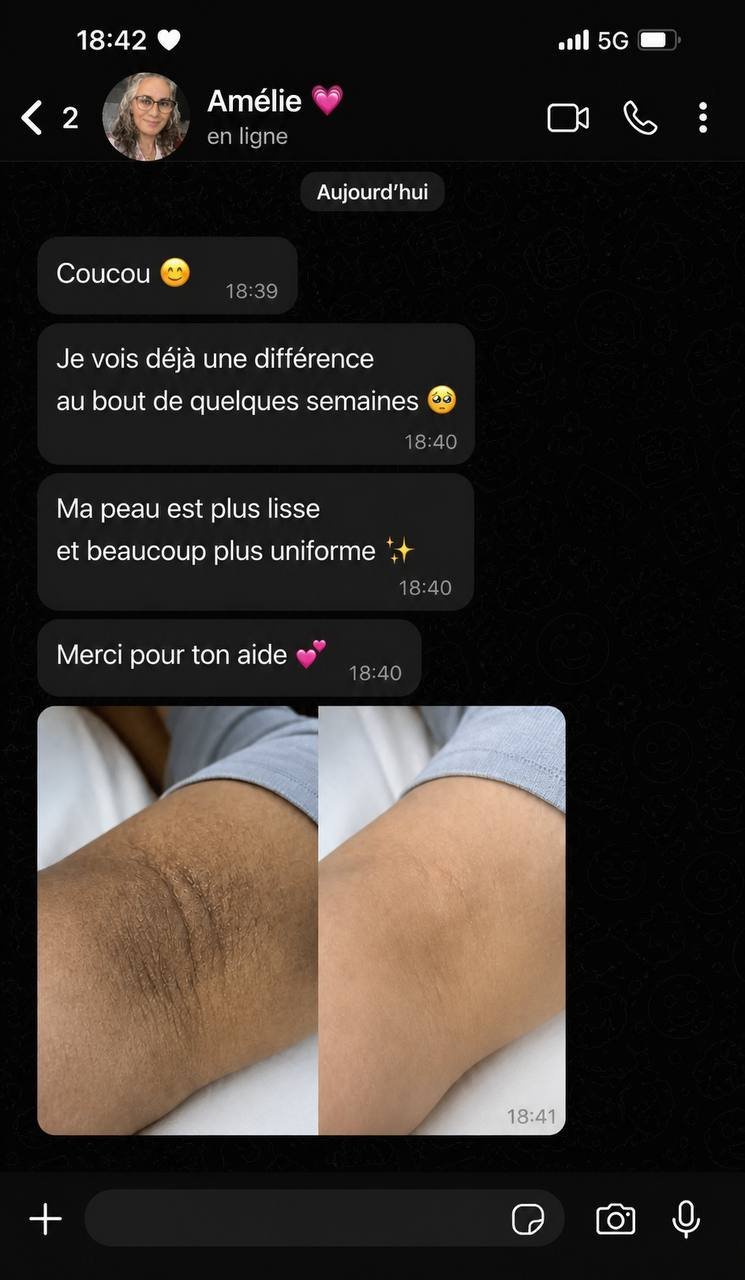 Témoignage 2
